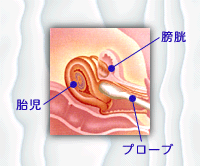 子宮 頚 管